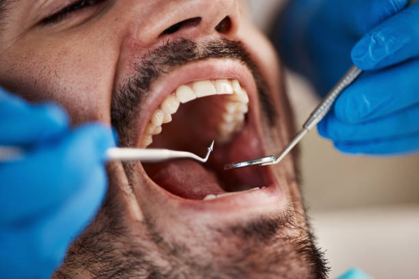 Emergency Dental Services in Rosharon, TX